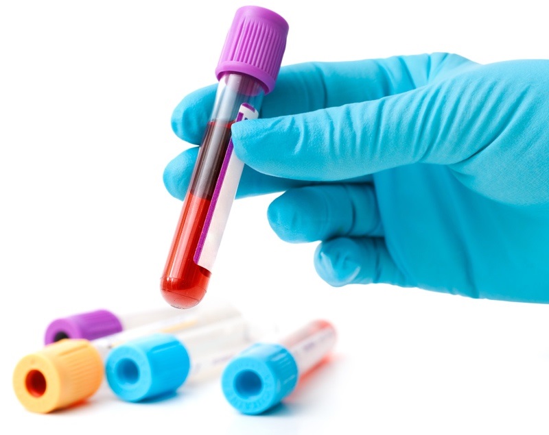 Blood test in a PET tube